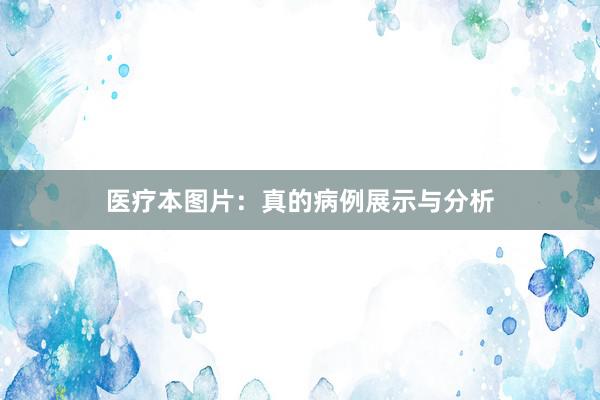 医疗本图片:真的病例展示与分析